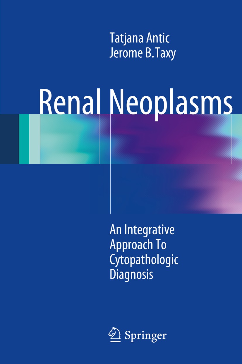 Titlebook: Renal Neoplasms; An Integrative Appro Tatjana Antic,Jerome B. Taxy Book 2014 Springer Science+Business Media New York 2014 cytomorphology.f Titlebook: Renal Neoplasms; An Integrative Appro Tatjana Antic,Jerome B. Taxy Book 2014 Springer Science+Business Media New York 2014 cytomorphology.f