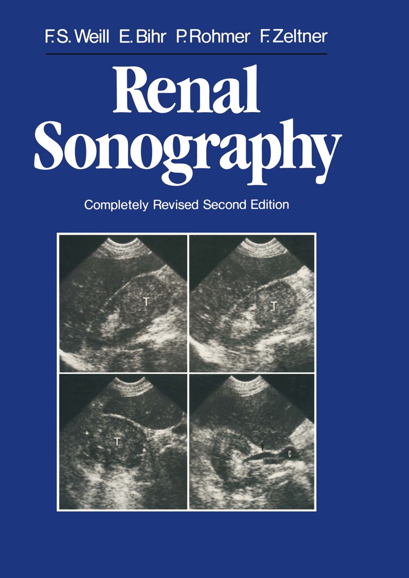 Titlebook: Renal Sonography; Francis S. Weill,Edmond Bihr,François Zeltner Book 1987Latest edition Springer-Verlag Berlin Heidelberg 1987 Nierenerkra Titlebook: Renal Sonography; Francis S. Weill,Edmond Bihr,François Zeltner Book 1987Latest edition Springer-Verlag Berlin Heidelberg 1987 Nierenerkra