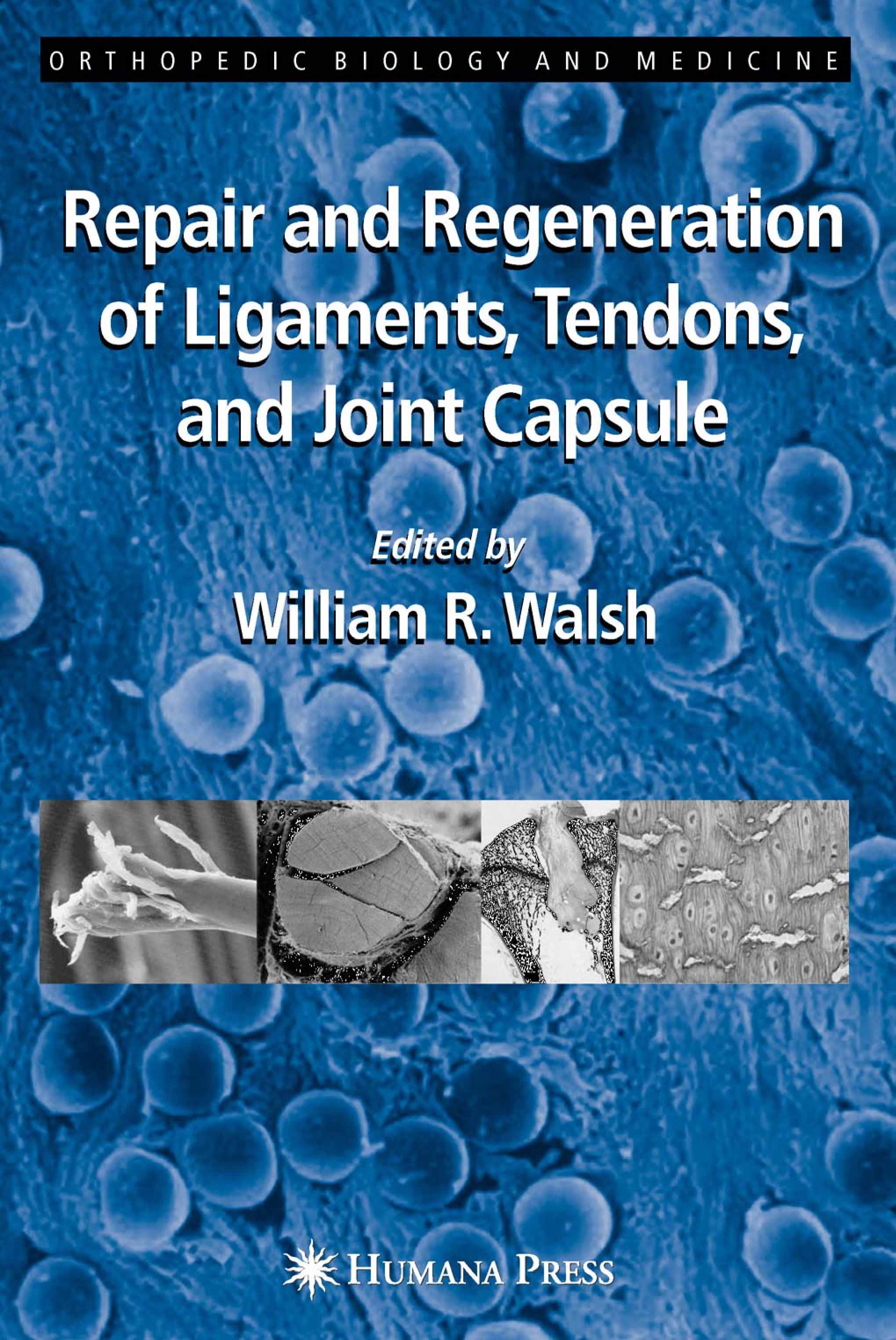 Titlebook: Repair and Regeneration of Ligaments, Tendons, and Joint Capsule; William R. Walsh Book 2006 Humana Press 2006 Frozen Shoulder.Surgery.bio Titlebook: Repair and Regeneration of Ligaments, Tendons, and Joint Capsule; William R. Walsh Book 2006 Humana Press 2006 Frozen Shoulder.Surgery.bio