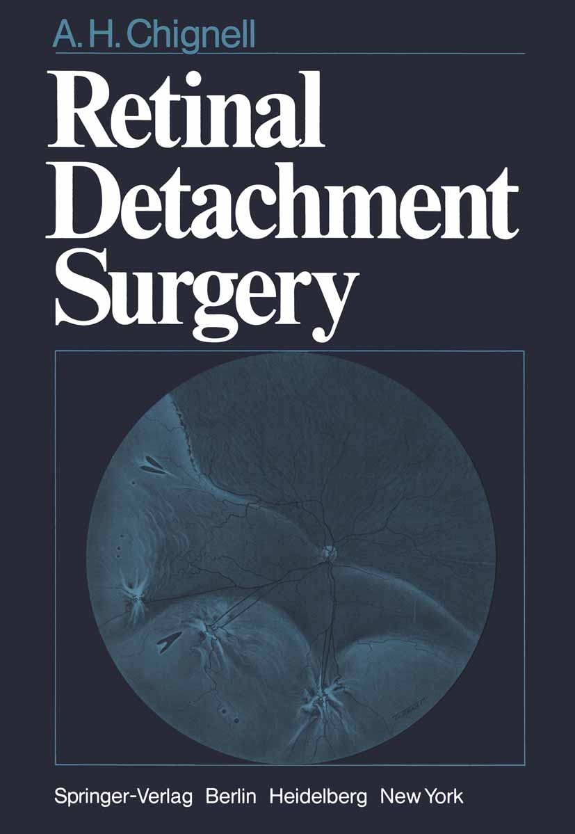 Titlebook: Retinal Detachment Surgery; Anthony H. Chignell Book 19801st edition Springer-Verlag Berlin Heidelberg 1980 Netzhautablösung.depression.di Titlebook: Retinal Detachment Surgery; Anthony H. Chignell Book 19801st edition Springer-Verlag Berlin Heidelberg 1980 Netzhautablösung.depression.di