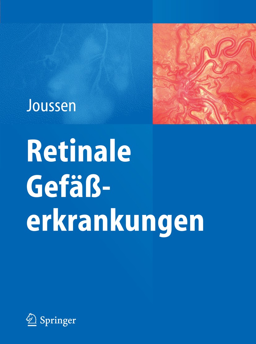 Titlebook: Retinale Gefäßerkrankungen; Antonia M. Joussen Book 2012 Springer-Verlag GmbH Germany 2012 Diabetische Retinopathie.Gefäßerkrankungen.Netz Titlebook: Retinale Gefäßerkrankungen; Antonia M. Joussen Book 2012 Springer-Verlag GmbH Germany 2012 Diabetische Retinopathie.Gefäßerkrankungen.Netz