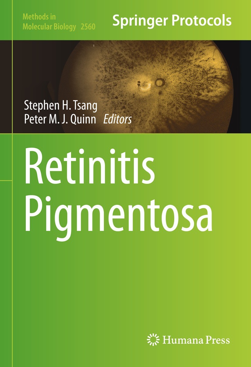 Titlebook: Retinitis Pigmentosa; Stephen H. Tsang,Peter M.J. Quinn Book 2023 The Editor(s) (if applicable) and The Author(s), under exclusive license Titlebook: Retinitis Pigmentosa; Stephen H. Tsang,Peter M.J. Quinn Book 2023 The Editor(s) (if applicable) and The Author(s), under exclusive license