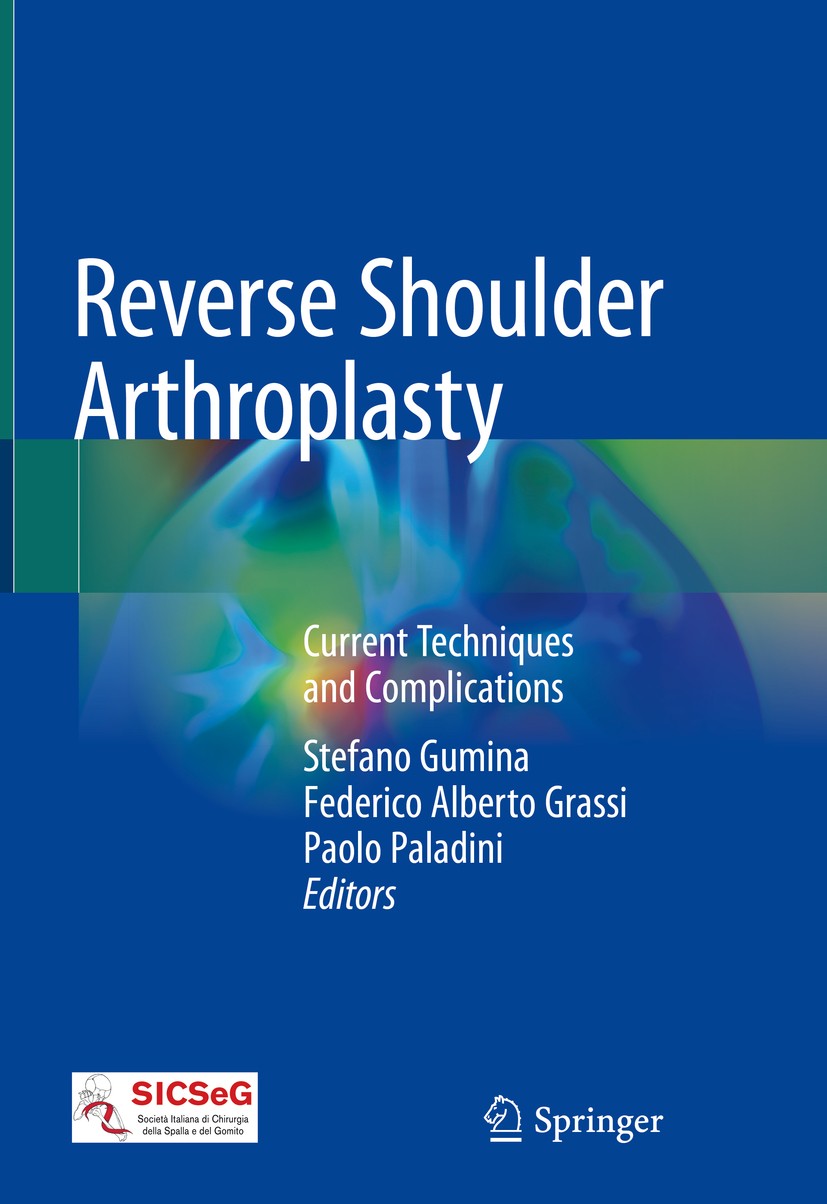 Titlebook: Reverse Shoulder Arthroplasty; Current Techniques a Stefano Gumina,Federico Alberto Grassi,Paolo Palad Book 2019 Springer Nature Switzerlan Titlebook: Reverse Shoulder Arthroplasty; Current Techniques a Stefano Gumina,Federico Alberto Grassi,Paolo Palad Book 2019 Springer Nature Switzerlan