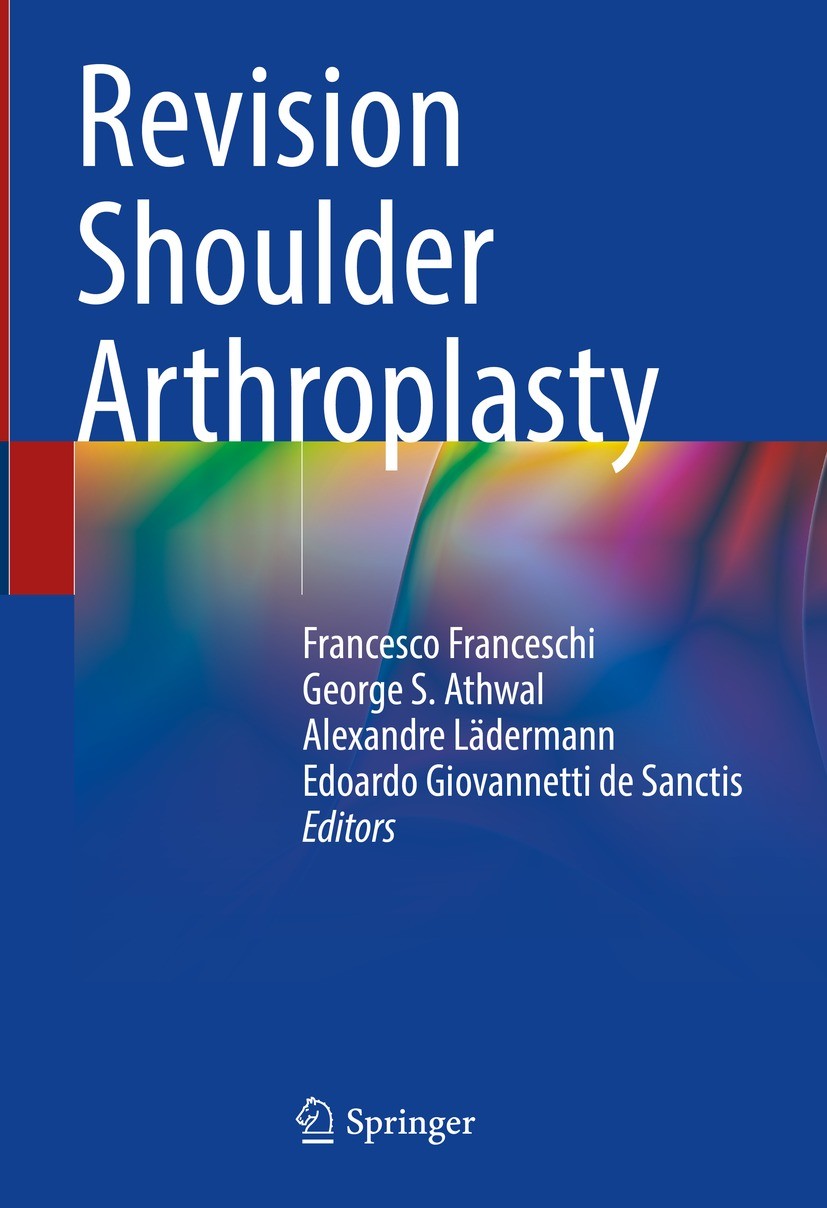Titlebook: Revision Shoulder Arthroplasty; Francesco Franceschi,George S. Athwal,Edoardo Giov Book 2023 The Editor(s) (if applicable) and The Author( Titlebook: Revision Shoulder Arthroplasty; Francesco Franceschi,George S. Athwal,Edoardo Giov Book 2023 The Editor(s) (if applicable) and The Author(