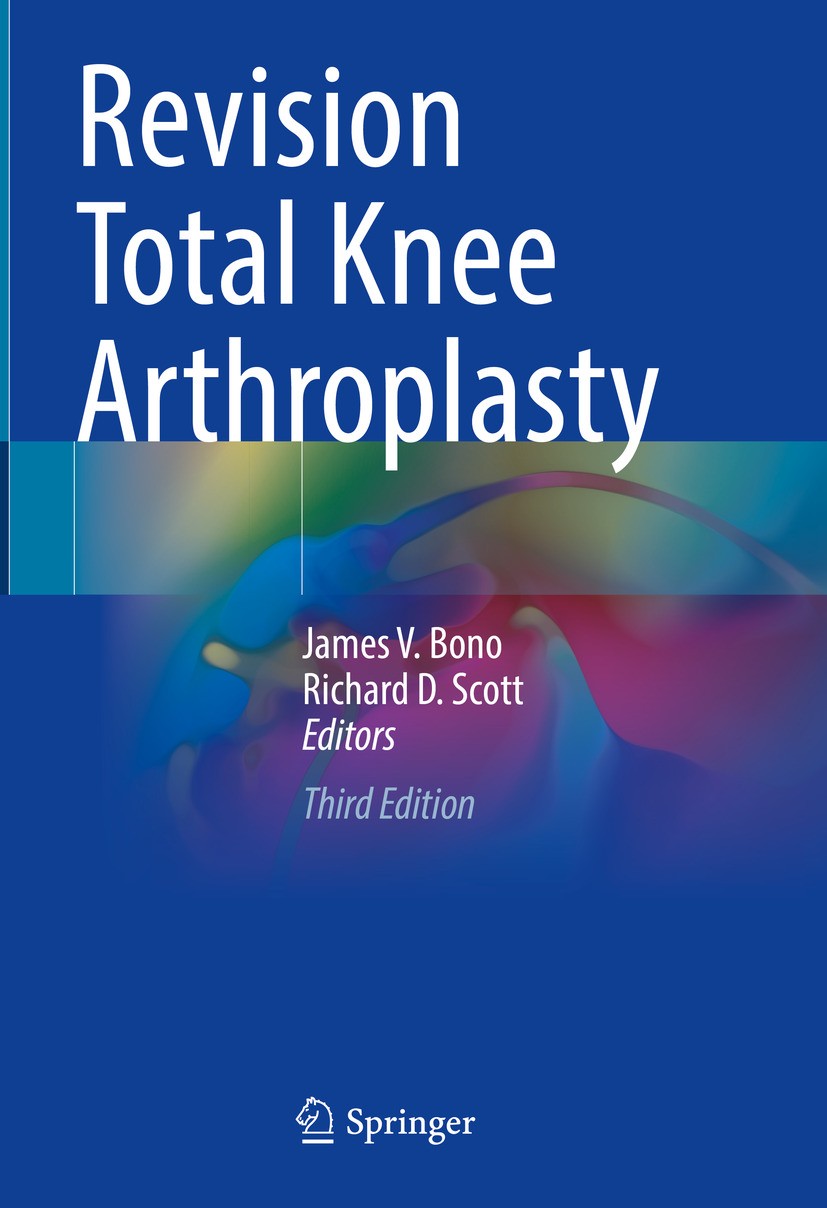Titlebook: Revision Total Knee Arthroplasty; James V. Bono,Richard D. Scott Book 2024Latest edition The Editor(s) (if applicable) and The Author(s), Titlebook: Revision Total Knee Arthroplasty; James V. Bono,Richard D. Scott Book 2024Latest edition The Editor(s) (if applicable) and The Author(s),