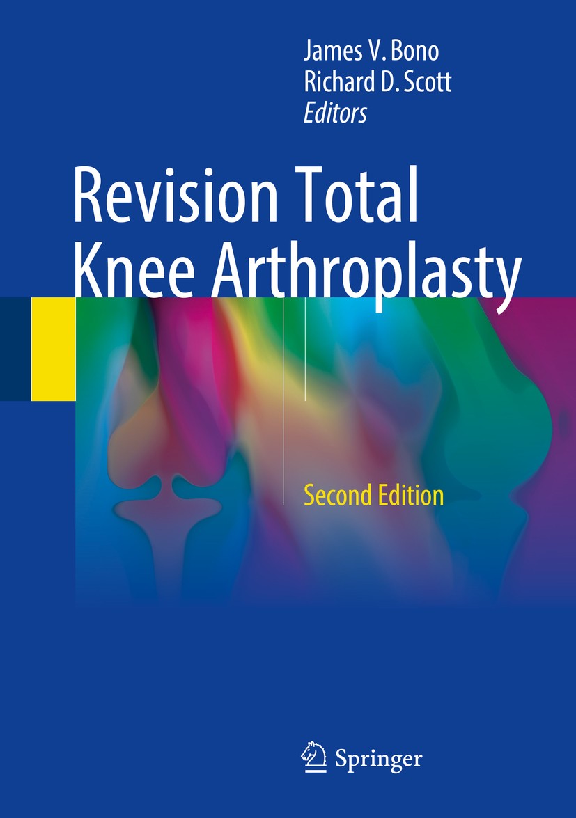 Titlebook: Revision Total Knee Arthroplasty; James V. Bono,Richard D. Scott Book 20182nd edition Springer International Publishing AG 2018 Allograft. Titlebook: Revision Total Knee Arthroplasty; James V. Bono,Richard D. Scott Book 20182nd edition Springer International Publishing AG 2018 Allograft.