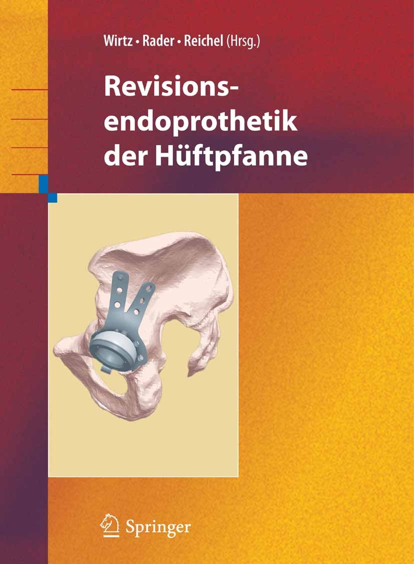 Titlebook: Revisionsendoprothetik der Hüftpfanne; Dieter C. Wirtz,Christof Rader,Heiko Reichel Book 2008 Springer-Verlag Berlin Heidelberg 2008 Endop Titlebook: Revisionsendoprothetik der Hüftpfanne; Dieter C. Wirtz,Christof Rader,Heiko Reichel Book 2008 Springer-Verlag Berlin Heidelberg 2008 Endop