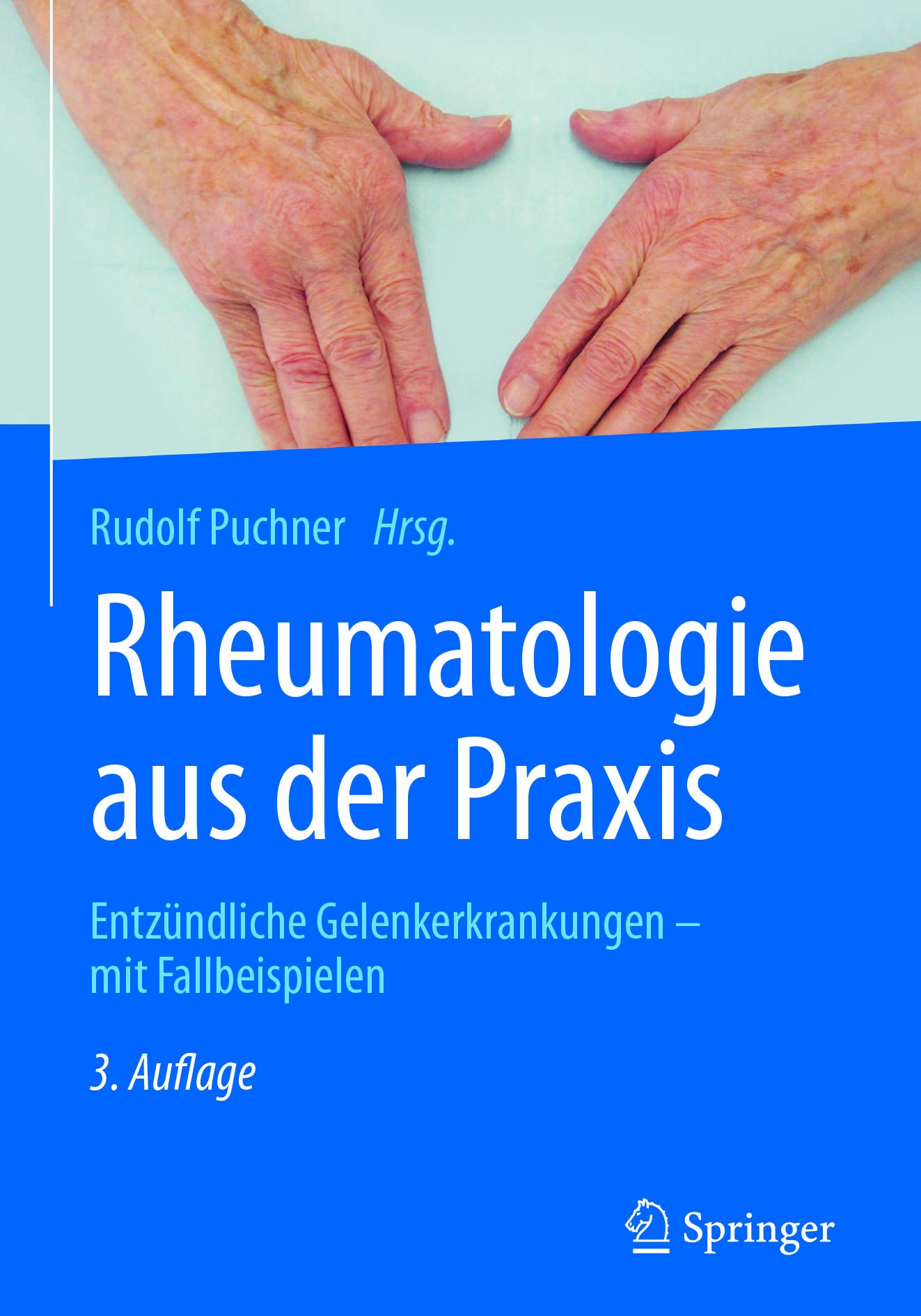 Titlebook: Rheumatologie aus der Praxis; Entzündliche Gelenke Rudolf Puchner Book 20173rd edition � Springer-Verlag GmbH Deutschland 2017 Rheumatologi Titlebook: Rheumatologie aus der Praxis; Entzündliche Gelenke Rudolf Puchner Book 20173rd edition � Springer-Verlag GmbH Deutschland 2017 Rheumatologi