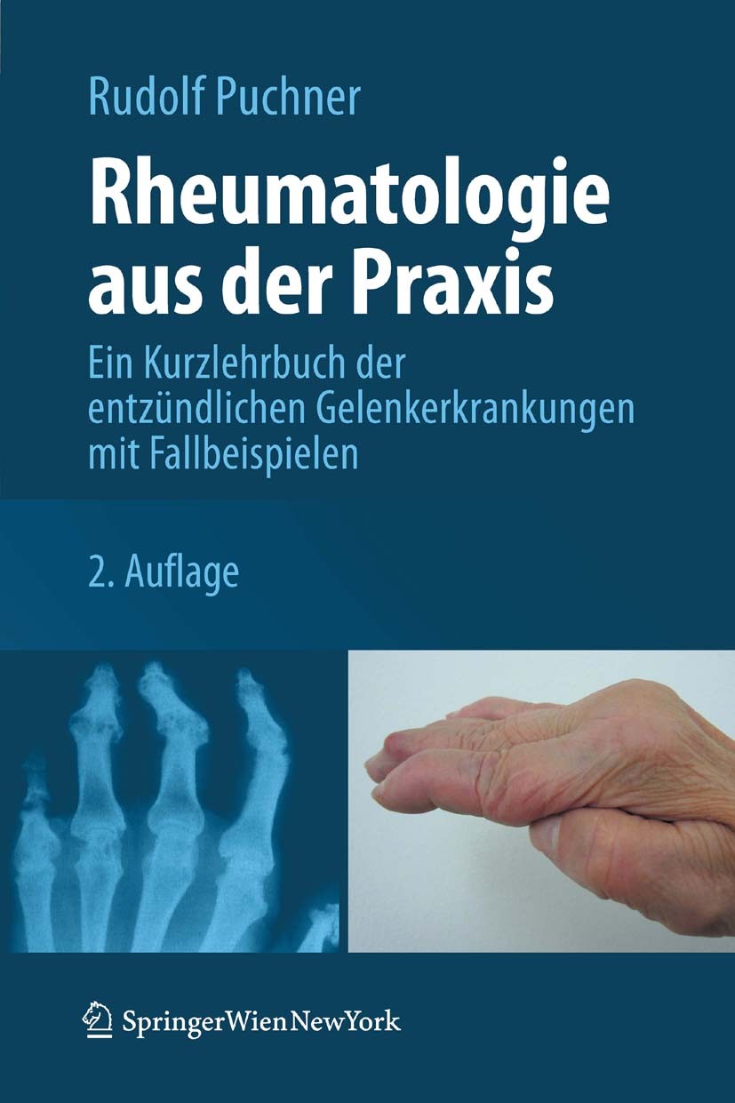 Titlebook: Rheumatologie aus der Praxis; Ein Kurzlehrbuch der Rudolf Puchner Book 2012Latest edition Springer-Verlag Vienna 2012 Rheumatologie.entzünd Titlebook: Rheumatologie aus der Praxis; Ein Kurzlehrbuch der Rudolf Puchner Book 2012Latest edition Springer-Verlag Vienna 2012 Rheumatologie.entzünd