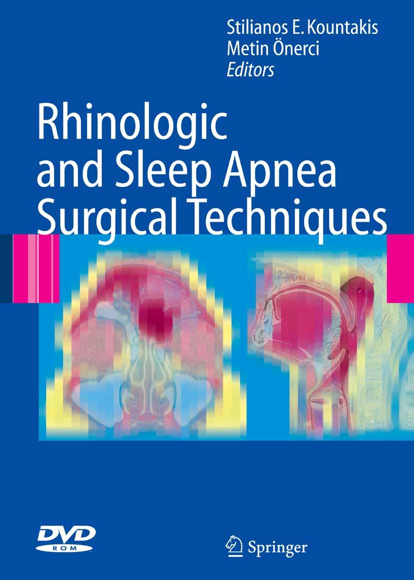 Titlebook: Rhinologic and Sleep Apnea Surgical Techniques; Stilanos E. Kountakis,Metin Önerci Book 20071st edition Springer-Verlag Berlin Heidelberg Titlebook: Rhinologic and Sleep Apnea Surgical Techniques; Stilanos E. Kountakis,Metin Önerci Book 20071st edition Springer-Verlag Berlin Heidelberg