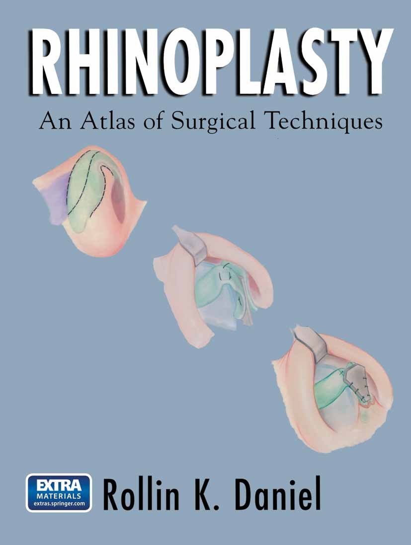 Titlebook: Rhinoplasty; An Atlas of Surgical Rollin K. Daniel Book 20021st edition Springer-Verlag New York 2002 aesthetics.rhinoplasty.surgical techn Titlebook: Rhinoplasty; An Atlas of Surgical Rollin K. Daniel Book 20021st edition Springer-Verlag New York 2002 aesthetics.rhinoplasty.surgical techn