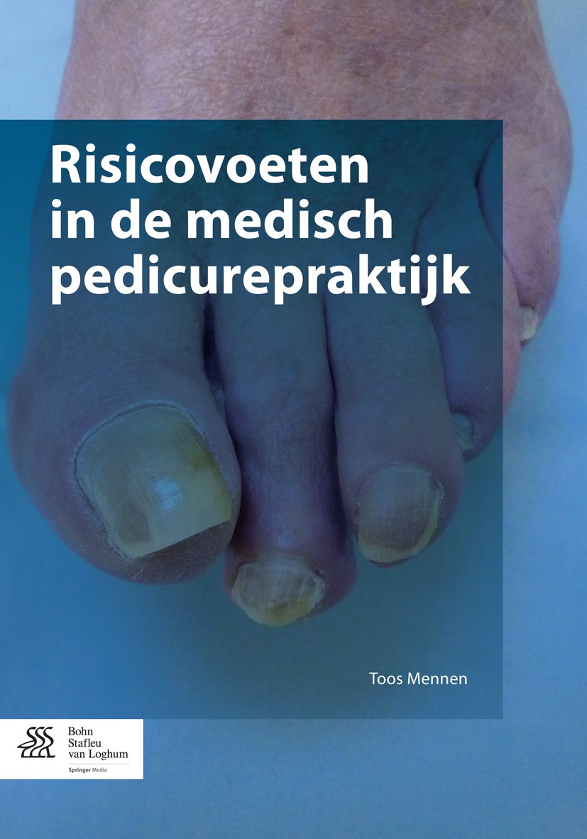 Titlebook: Risicovoeten in de medisch pedicurepraktijk; Toos Mennen Book 2015Latest edition Bohn Stafleu van Loghum 2015 Diabetische voet.Medisch ped Titlebook: Risicovoeten in de medisch pedicurepraktijk; Toos Mennen Book 2015Latest edition Bohn Stafleu van Loghum 2015 Diabetische voet.Medisch ped
