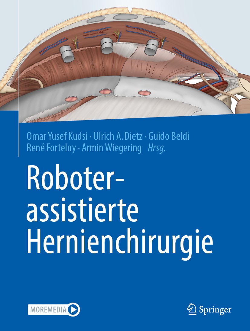 Titlebook: Roboterassistierte Hernienchirurgie; Omar Yusef Kudsi,Ulrich A. Dietz,Armin Wiegering Book 2024 Der/die Herausgeber bzw. der/die Autor(en) Titlebook: Roboterassistierte Hernienchirurgie; Omar Yusef Kudsi,Ulrich A. Dietz,Armin Wiegering Book 2024 Der/die Herausgeber bzw. der/die Autor(en)