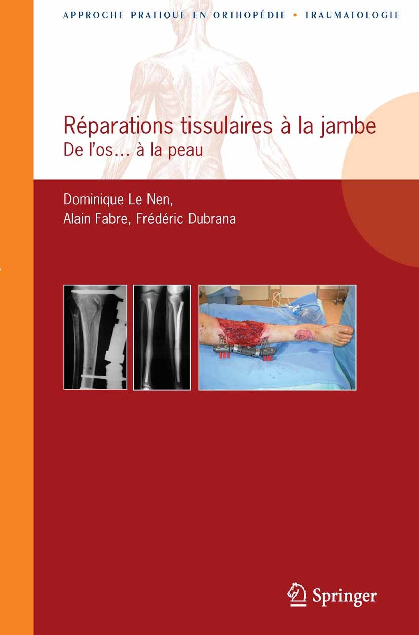 Titlebook: Réparations tissulaires à la jambe; De l’os...à la peau Dominique Nen,Alain Fabre,Frédéric Dubrana Book 2012Latest edition Springer-Verlag Titlebook: Réparations tissulaires à la jambe; De l’os...à la peau Dominique Nen,Alain Fabre,Frédéric Dubrana Book 2012Latest edition Springer-Verlag