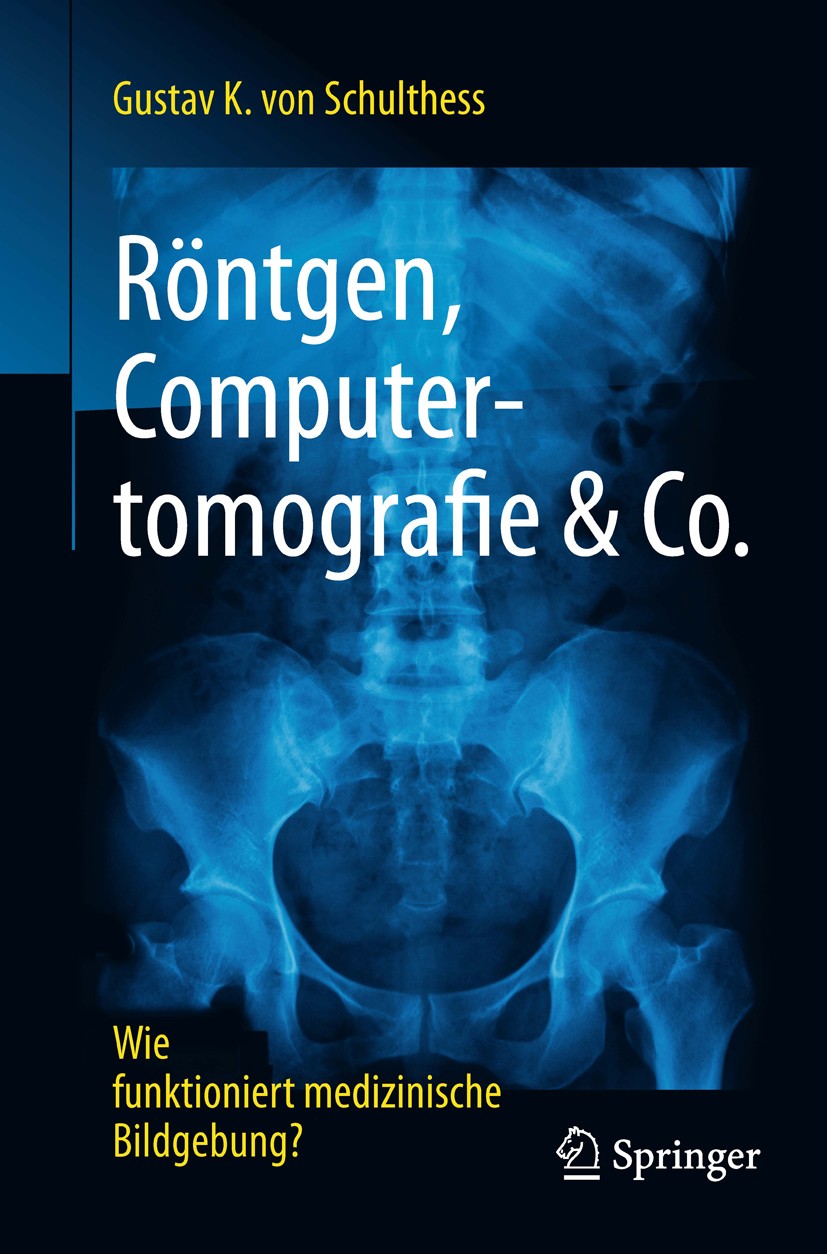 Titlebook: Röntgen, Computertomografie & Co.; Wie funktioniert med Gustav K. Schulthess Book 2017 Springer-Verlag GmbH Germany 2017 CT.MRT.MRI.XRay.Rö Titlebook: Röntgen, Computertomografie & Co.; Wie funktioniert med Gustav K. Schulthess Book 2017 Springer-Verlag GmbH Germany 2017 CT.MRT.MRI.XRay.Rö