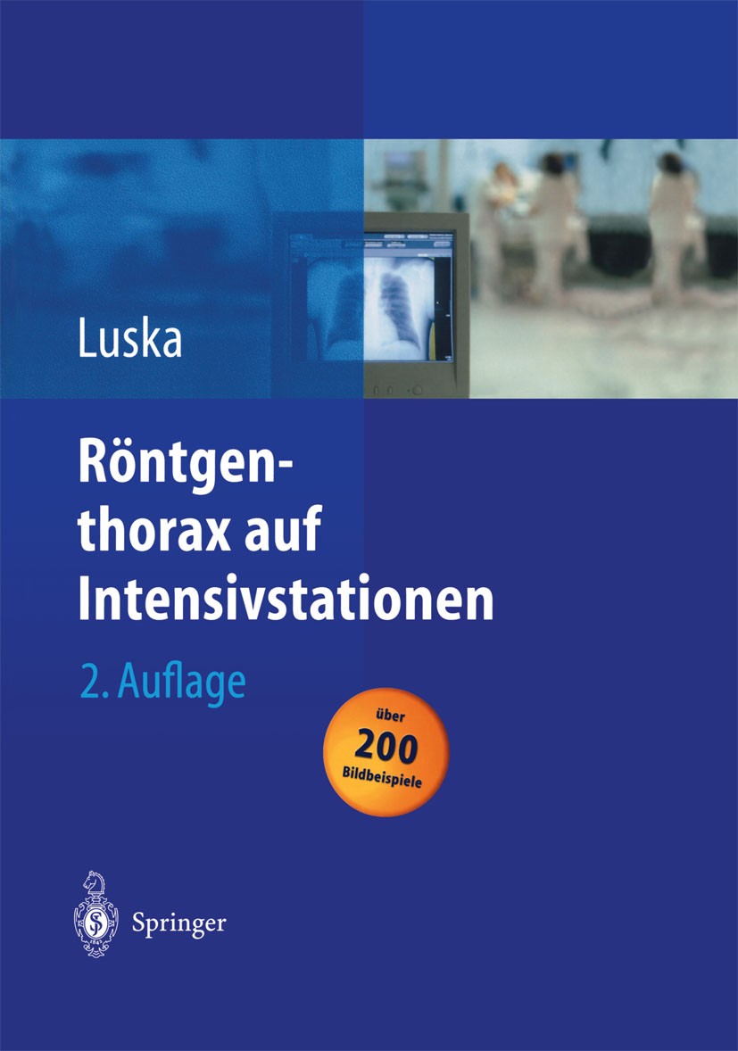 Titlebook: Röntgenthorax auf Intensivstationen; Günter Luska Book 2004Latest edition Springer-Verlag Berlin Heidelberg 2004 Anatomie.Diagnostik.Grund Titlebook: Röntgenthorax auf Intensivstationen; Günter Luska Book 2004Latest edition Springer-Verlag Berlin Heidelberg 2004 Anatomie.Diagnostik.Grund