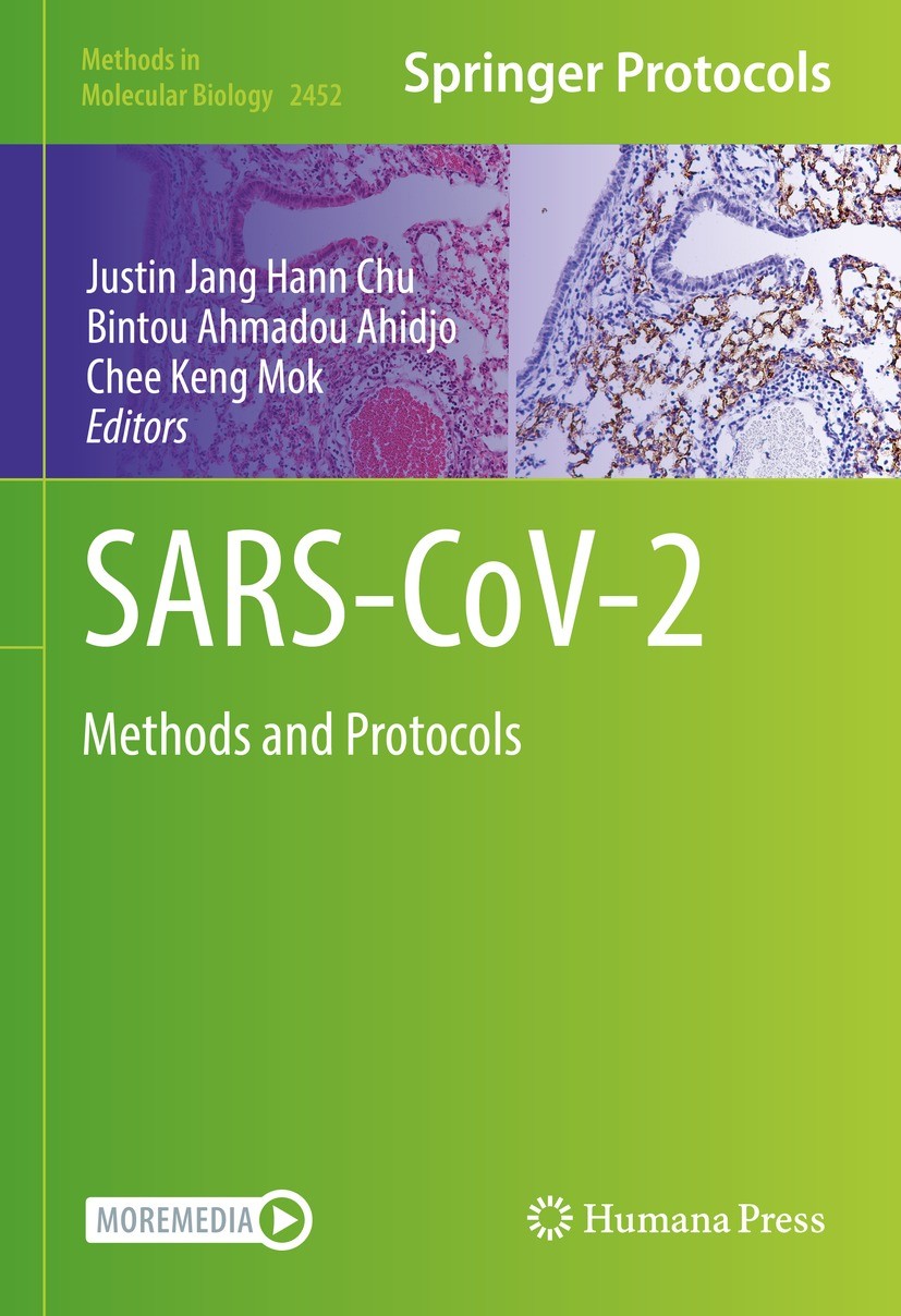 Titlebook: SARS-CoV-2; Methods and Protocol Justin Jang Hann Chu,Bintou Ahmadou Ahidjo,Chee Ke Book 2022 The Editor(s) (if applicable) and The Author( Titlebook: SARS-CoV-2; Methods and Protocol Justin Jang Hann Chu,Bintou Ahmadou Ahidjo,Chee Ke Book 2022 The Editor(s) (if applicable) and The Author(