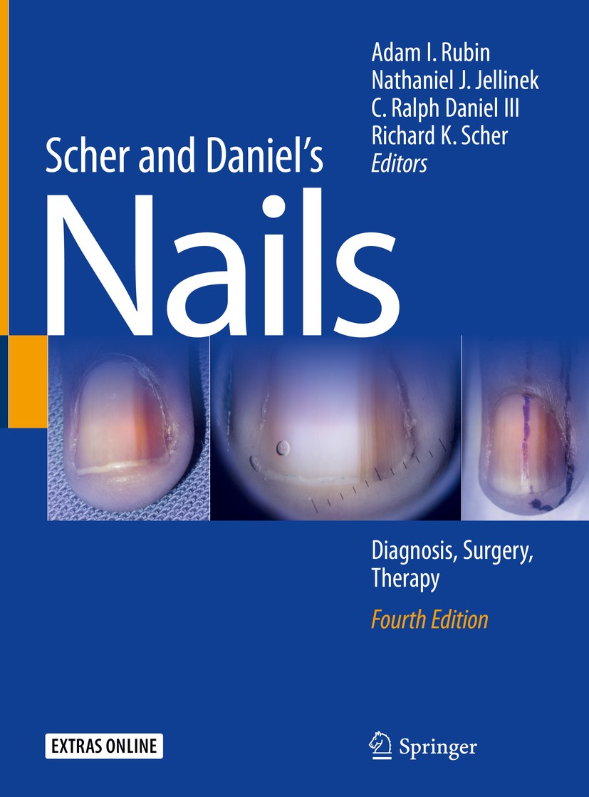 Titlebook: Scher and Daniel‘s Nails; Diagnosis, Surgery, Adam I. Rubin,Nathaniel J. Jellinek,Richard K. Sch Textbook 2018Latest edition Springer Inte Titlebook: Scher and Daniel‘s Nails; Diagnosis, Surgery, Adam I. Rubin,Nathaniel J. Jellinek,Richard K. Sch Textbook 2018Latest edition Springer Inte