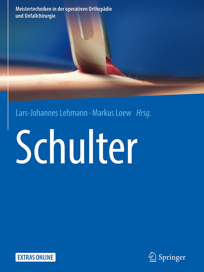 Titlebook: Schulter; Lars-Johannes Lehmann,Markus Loew Book 2018 Springer-Verlag GmbH Deutschland 2018 Master Techniques.Vordere Instabilität.Hintere Titlebook: Schulter; Lars-Johannes Lehmann,Markus Loew Book 2018 Springer-Verlag GmbH Deutschland 2018 Master Techniques.Vordere Instabilität.Hintere