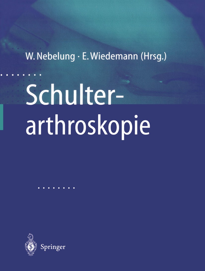 Titlebook: Schulterarthroskopie; Wolfgang Nebelung,Ernst Wiedemann Book 2002 Springer-Verlag Berlin Heidelberg 2002 Arthrose.Arthroskopie.Chirurgie.I Titlebook: Schulterarthroskopie; Wolfgang Nebelung,Ernst Wiedemann Book 2002 Springer-Verlag Berlin Heidelberg 2002 Arthrose.Arthroskopie.Chirurgie.I