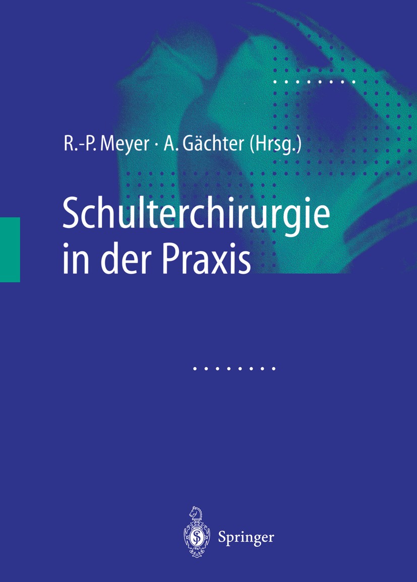 Titlebook: Schulterchirurgie in der Praxis; Rainer-Peter Meyer,André Gächter Book 2001 Springer-Verlag Berlin Heidelberg 2001 Anatomie.Arthroskopie.C Titlebook: Schulterchirurgie in der Praxis; Rainer-Peter Meyer,André Gächter Book 2001 Springer-Verlag Berlin Heidelberg 2001 Anatomie.Arthroskopie.C