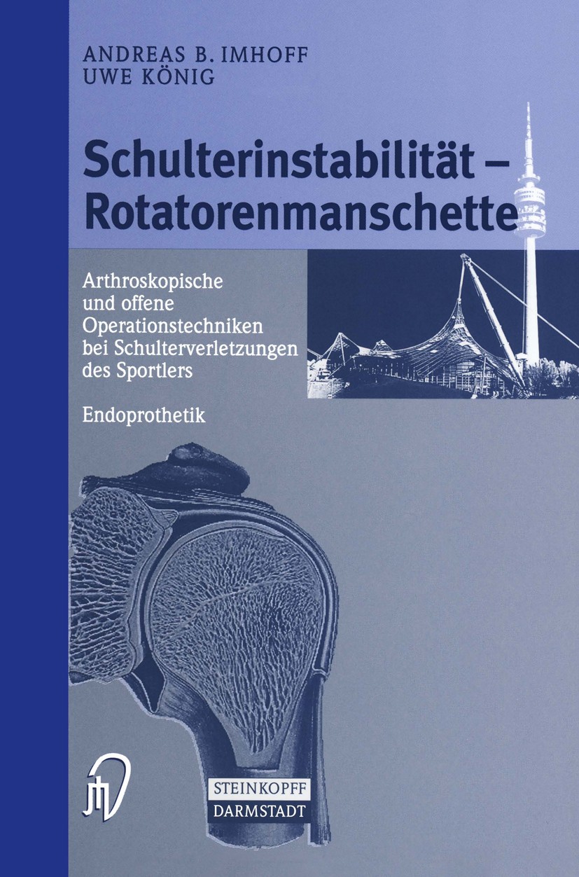 Titlebook: Schulterinstabilität — Rotatorenmanschette; Arthroskopische und Andreas B. Imhoff,Uwe König Book 1999 Springer-Verlag Berlin Heidelberg 19 Titlebook: Schulterinstabilität — Rotatorenmanschette; Arthroskopische und Andreas B. Imhoff,Uwe König Book 1999 Springer-Verlag Berlin Heidelberg 19