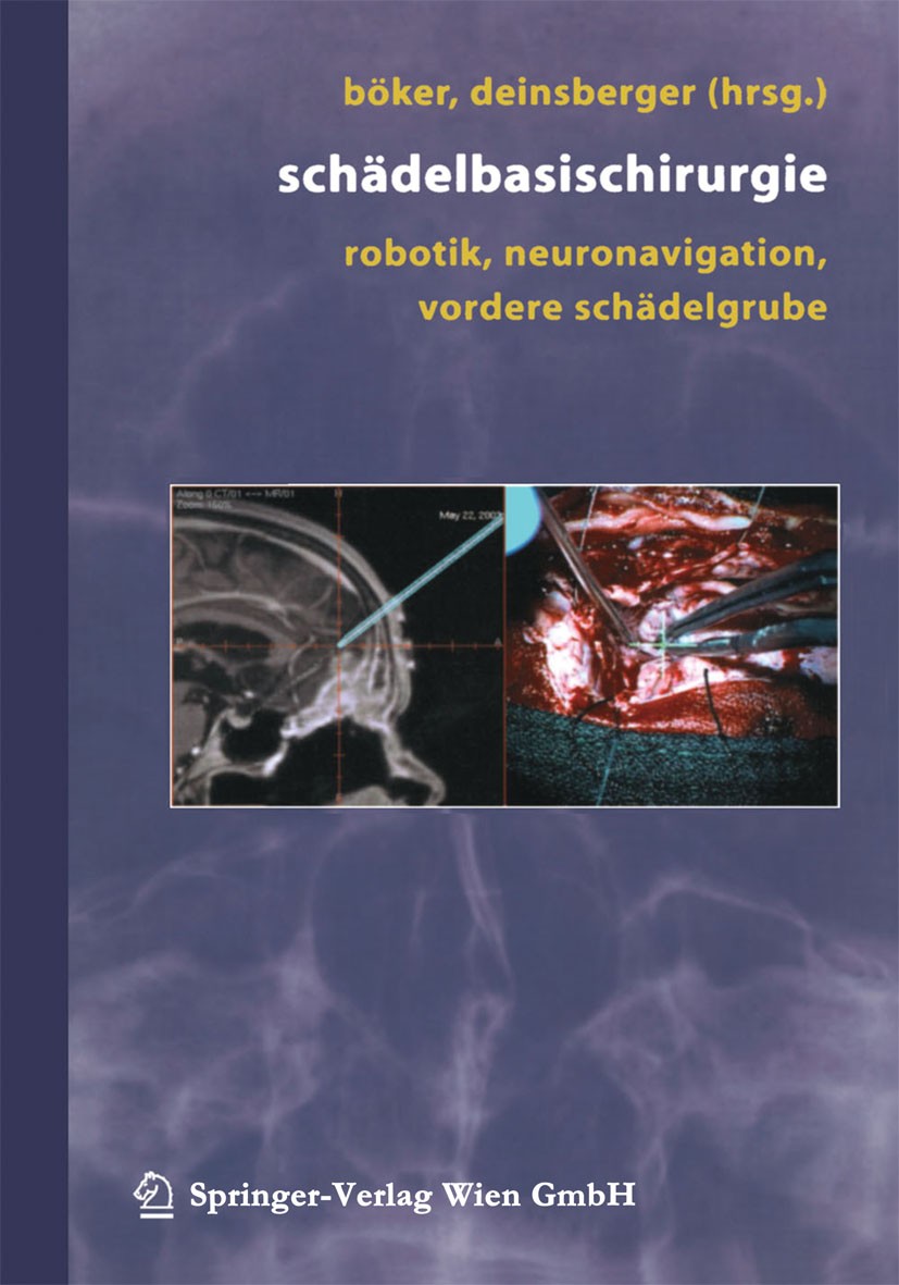 Titlebook: Schädelbasischirurgie; Robotik, Neuronaviga D.-K. Böker,W. Deinsberger Conference proceedings 2004 Springer-Verlag/Wien 2004 Augenmuskelpar Titlebook: Schädelbasischirurgie; Robotik, Neuronaviga D.-K. Böker,W. Deinsberger Conference proceedings 2004 Springer-Verlag/Wien 2004 Augenmuskelpar