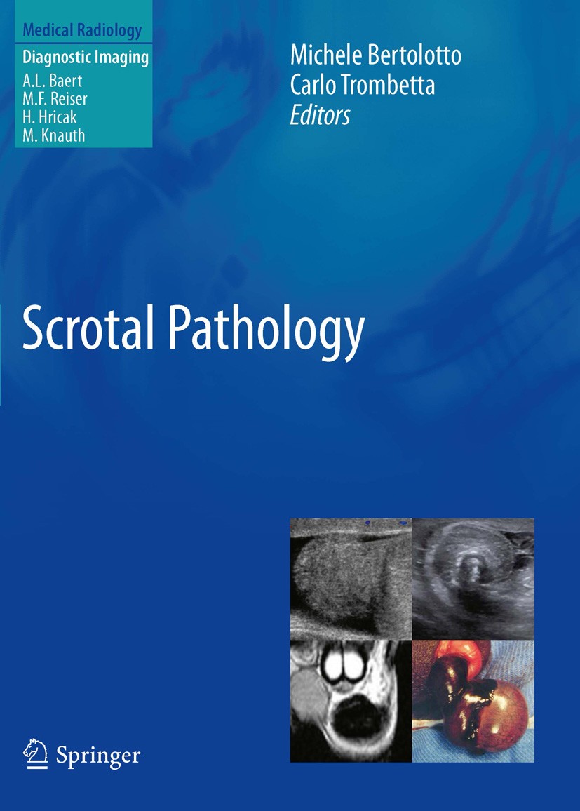 Titlebook: Scrotal Pathology; Michele Bertolotto,Carlo Trombetta Book 2012 Springer-Verlag Berlin Heidelberg 2012 Scrotal pathologies.Scrotum, diseas Titlebook: Scrotal Pathology; Michele Bertolotto,Carlo Trombetta Book 2012 Springer-Verlag Berlin Heidelberg 2012 Scrotal pathologies.Scrotum, diseas