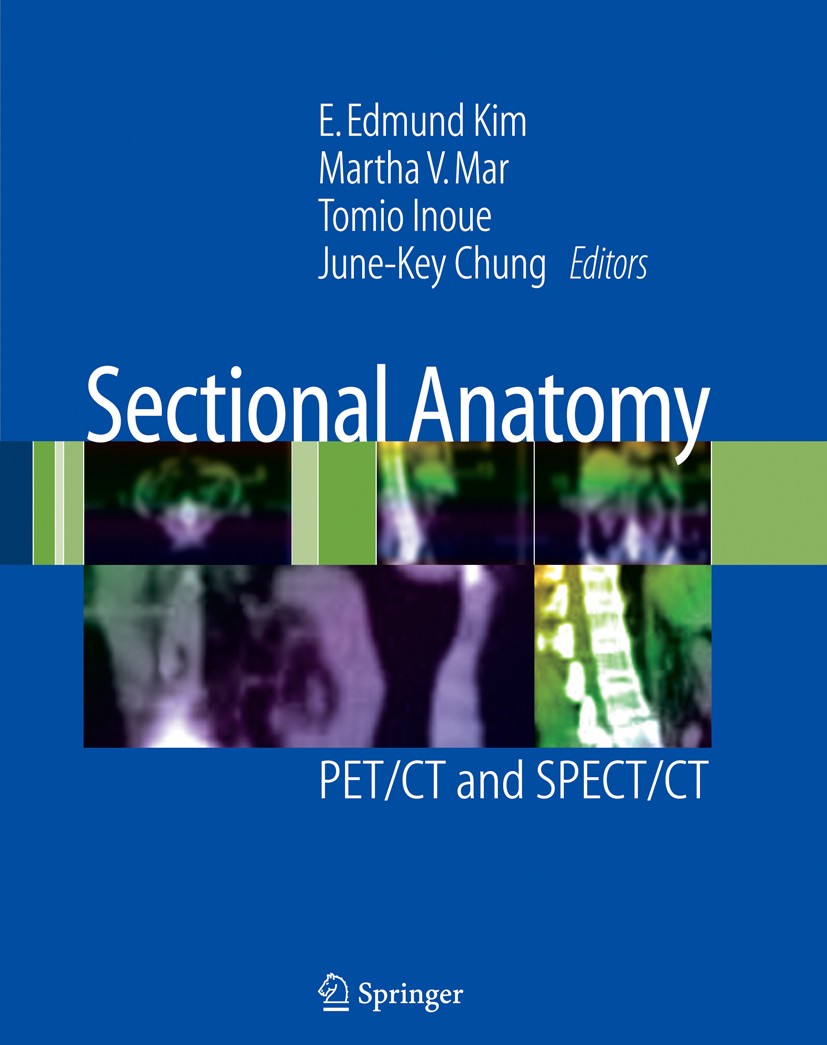 Titlebook: Sectional Anatomy; PET/CT and SPECT/CT E. Edmund Kim (Professor of Radiology and Medicine Book 2007 Springer-Verlag New York 2007 Computed. Titlebook: Sectional Anatomy; PET/CT and SPECT/CT E. Edmund Kim (Professor of Radiology and Medicine Book 2007 Springer-Verlag New York 2007 Computed.