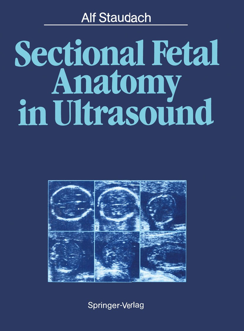 Titlebook: Sectional Fetal Anatomy in Ultrasound; Alf Staudach Book 1987 Springer-Verlag Berlin Heidelberg 1987 abdomen.anatomy.brain.diagnosis.fetus Titlebook: Sectional Fetal Anatomy in Ultrasound; Alf Staudach Book 1987 Springer-Verlag Berlin Heidelberg 1987 abdomen.anatomy.brain.diagnosis.fetus