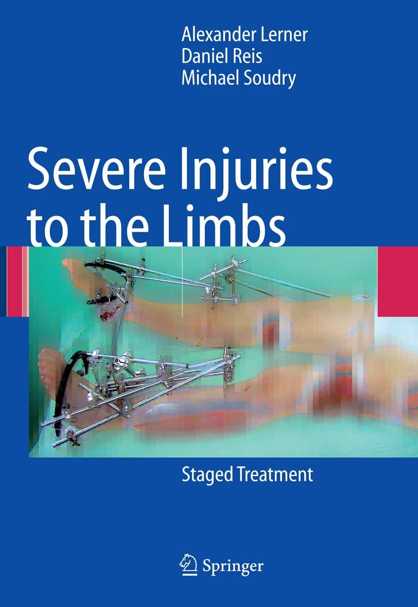 Titlebook: Severe Injuries to the Limbs; Staged Treatment Alexander Lerner,Daniel Reis,Michael Soudry Book 2007 Springer-Verlag Berlin Heidelberg 2007 Titlebook: Severe Injuries to the Limbs; Staged Treatment Alexander Lerner,Daniel Reis,Michael Soudry Book 2007 Springer-Verlag Berlin Heidelberg 2007
