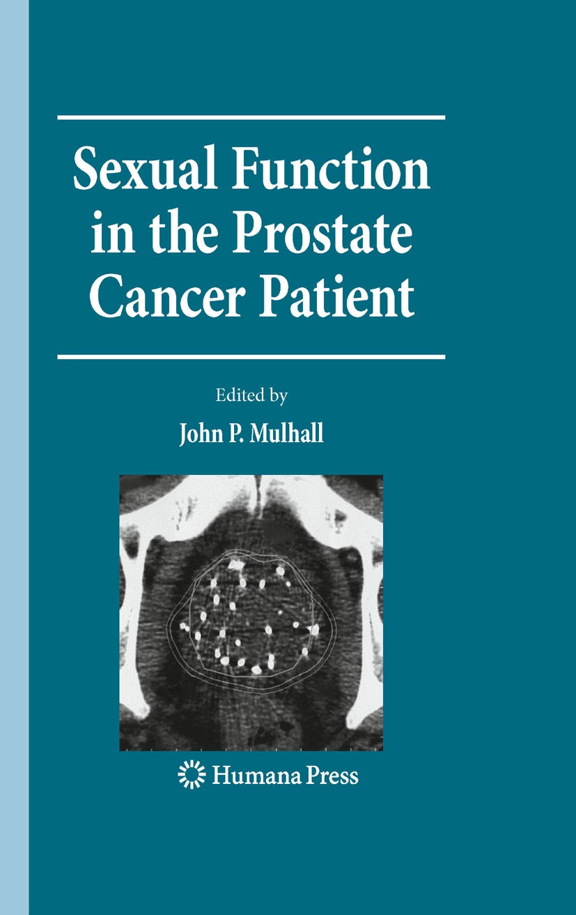 Titlebook: Sexual Function in the Prostate Cancer Patient; John P. Mulhall Book 2009 Humana Press 2009 Rehabilitation.anti-androgen therapy.erectile Titlebook: Sexual Function in the Prostate Cancer Patient; John P. Mulhall Book 2009 Humana Press 2009 Rehabilitation.anti-androgen therapy.erectile