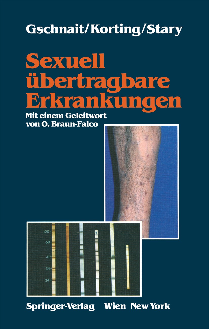Titlebook: Sexuell übertragbare Erkrankungen; Fritz Gschnait,Hans Christian Korting,Angelika Sta Book 1990 Springer-Verlag/Wien 1990 Allgemeinmedizin Titlebook: Sexuell übertragbare Erkrankungen; Fritz Gschnait,Hans Christian Korting,Angelika Sta Book 1990 Springer-Verlag/Wien 1990 Allgemeinmedizin