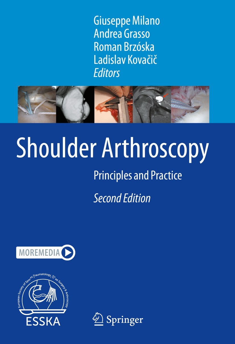 Titlebook: Shoulder Arthroscopy; Principles and Pract Giuseppe Milano,Andrea Grasso,Ladislav Kovačič Book 2023Latest edition Springer-Verlag GmbH Germ Titlebook: Shoulder Arthroscopy; Principles and Pract Giuseppe Milano,Andrea Grasso,Ladislav Kovačič Book 2023Latest edition Springer-Verlag GmbH Germ
