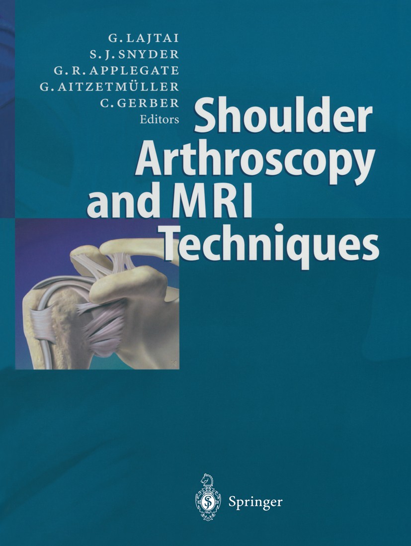 Titlebook: Shoulder Arthroscopy and MRI Techniques; Georg Lajtai,Stephen J. Snyder,Christian Gerber Book 2003 Springer-Verlag Berlin Heidelberg 2003 Titlebook: Shoulder Arthroscopy and MRI Techniques; Georg Lajtai,Stephen J. Snyder,Christian Gerber Book 2003 Springer-Verlag Berlin Heidelberg 2003