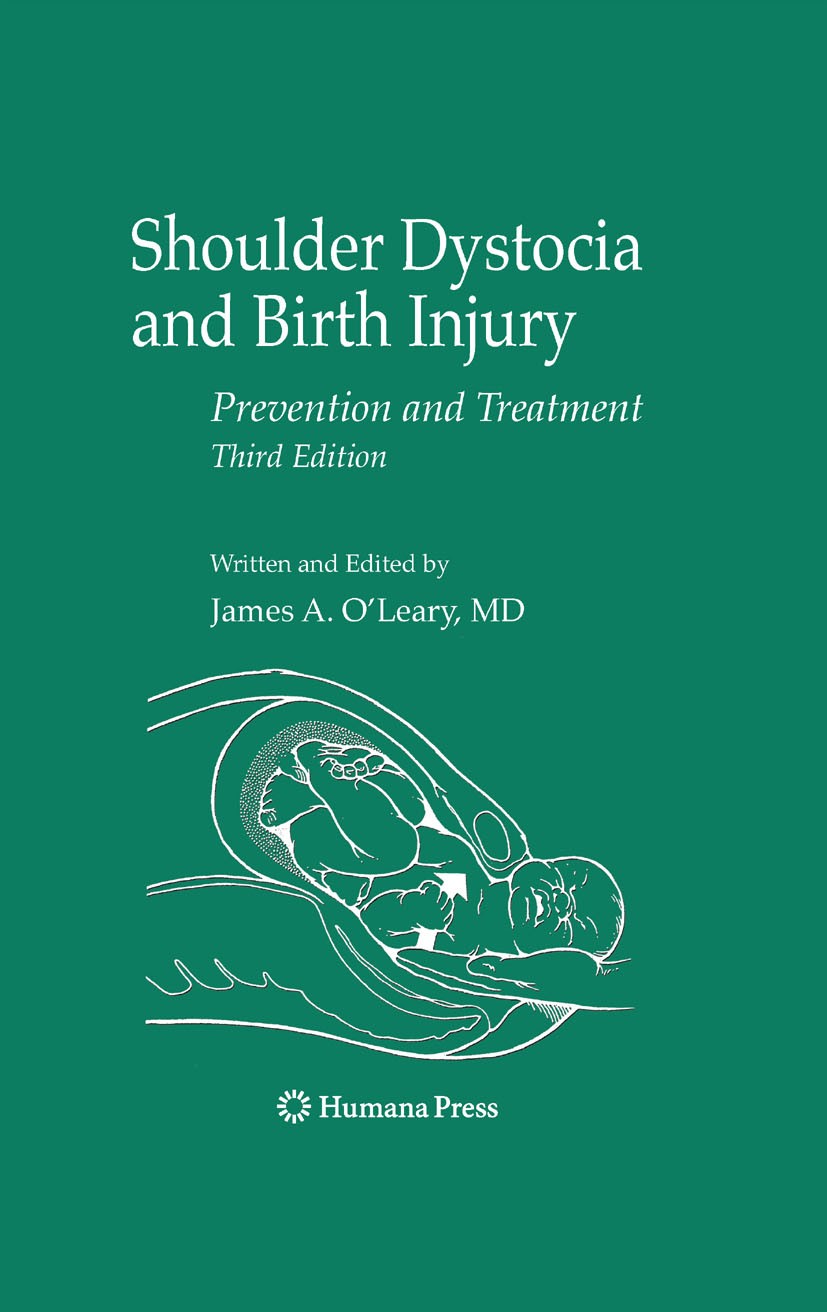 Titlebook: Shoulder Dystocia and Birth Injury; Prevention and Treat James A. O‘Leary Book 2009Latest edition Humana Press 2009 Delivery techniques.Man Titlebook: Shoulder Dystocia and Birth Injury; Prevention and Treat James A. O‘Leary Book 2009Latest edition Humana Press 2009 Delivery techniques.Man