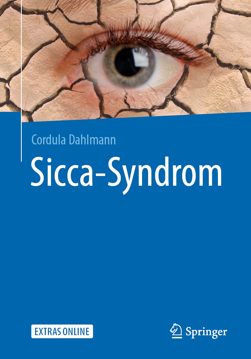 Titlebook: Sicca-Syndrom; Cordula Dahlmann Book 2019 Springer-Verlag GmbH Deutschland, ein Teil von Springer Nature 2019 Trockenes Auge.Meibomdrüsend Titlebook: Sicca-Syndrom; Cordula Dahlmann Book 2019 Springer-Verlag GmbH Deutschland, ein Teil von Springer Nature 2019 Trockenes Auge.Meibomdrüsend