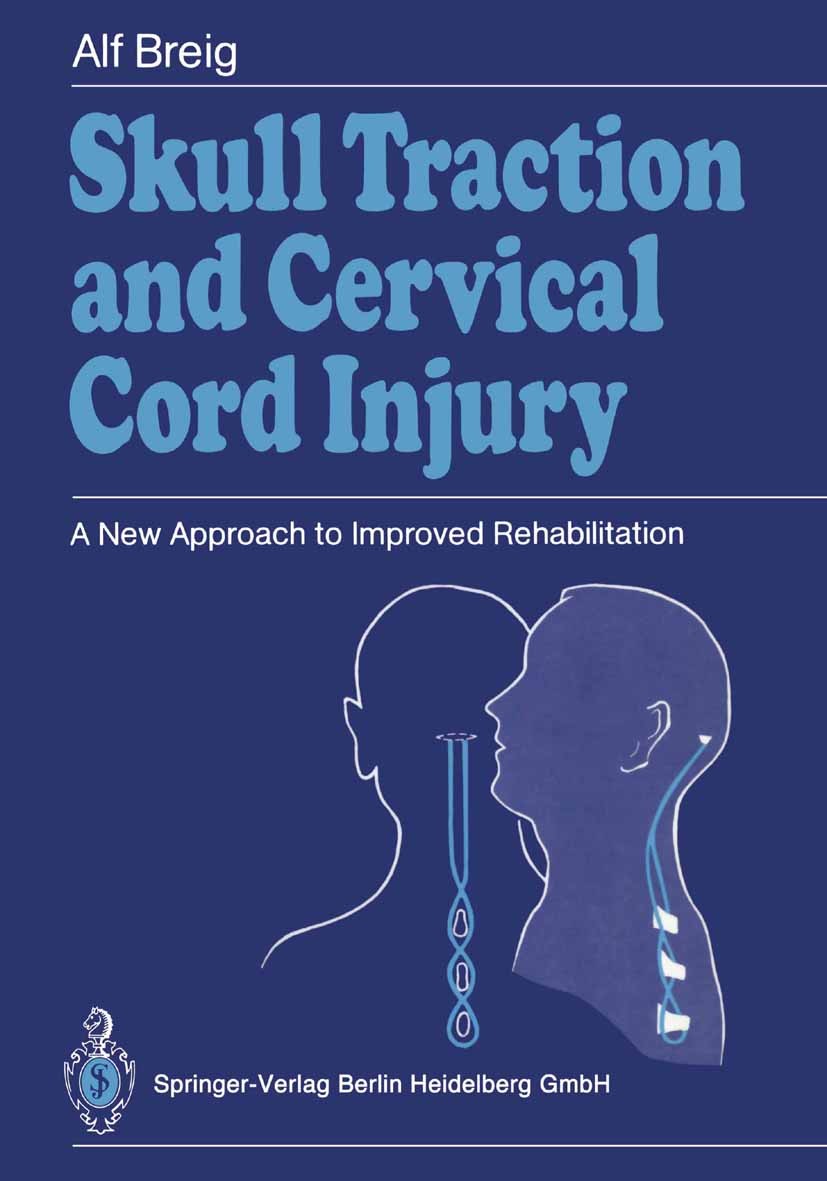 Titlebook: Skull Traction and Cervical Cord Injury; A New Approach to Im Alf Breig Book 1989 Springer-Verlag Berlin Heidelberg 1989 biomechanics.centr Titlebook: Skull Traction and Cervical Cord Injury; A New Approach to Im Alf Breig Book 1989 Springer-Verlag Berlin Heidelberg 1989 biomechanics.centr
