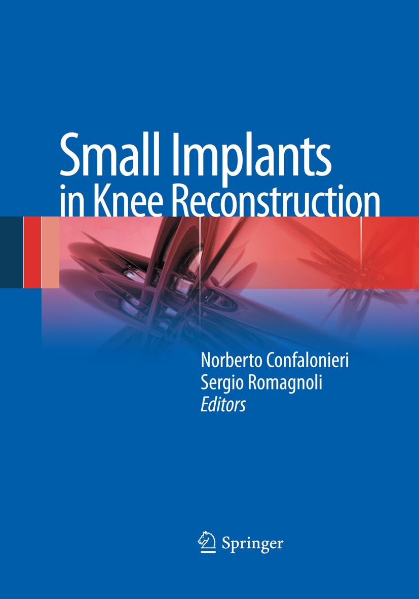 Titlebook: Small Implants in Knee Reconstruction; Norberto Confalonieri,Sergio Romagnoli Book 2013 Springer-Verlag Italia Srl. 2013 ACL-sparing.arthr Titlebook: Small Implants in Knee Reconstruction; Norberto Confalonieri,Sergio Romagnoli Book 2013 Springer-Verlag Italia Srl. 2013 ACL-sparing.arthr