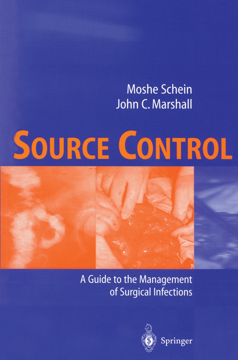 Titlebook: Source Control; A Guide to the Manag Moshe Schein (Professor of Surgery),John C. Marsha Book 2003 Springer-Verlag Berlin Heidelberg 2003 So Titlebook: Source Control; A Guide to the Manag Moshe Schein (Professor of Surgery),John C. Marsha Book 2003 Springer-Verlag Berlin Heidelberg 2003 So