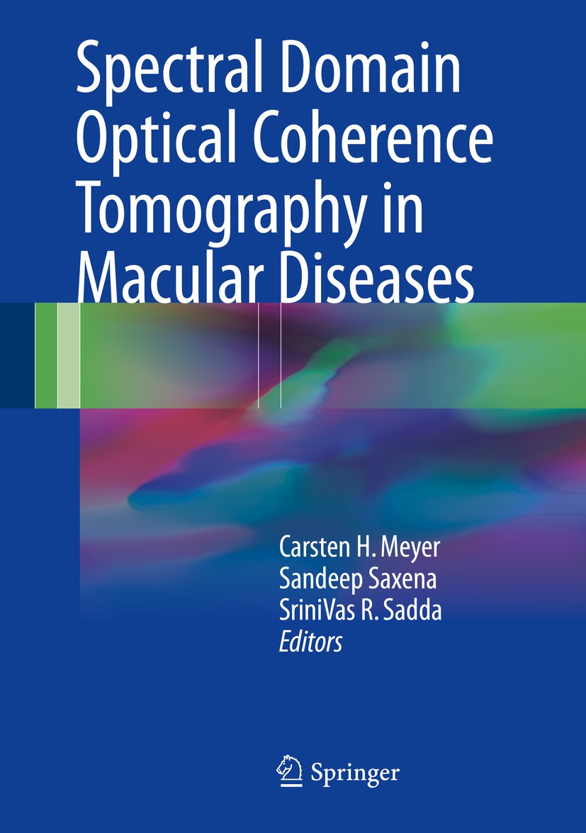 Titlebook: Spectral Domain Optical Coherence Tomography in Macular Diseases; Carsten H. Meyer,Sandeep Saxena,SriniVas R Sadda Book 2017 Springer Indi Titlebook: Spectral Domain Optical Coherence Tomography in Macular Diseases; Carsten H. Meyer,Sandeep Saxena,SriniVas R Sadda Book 2017 Springer Indi
