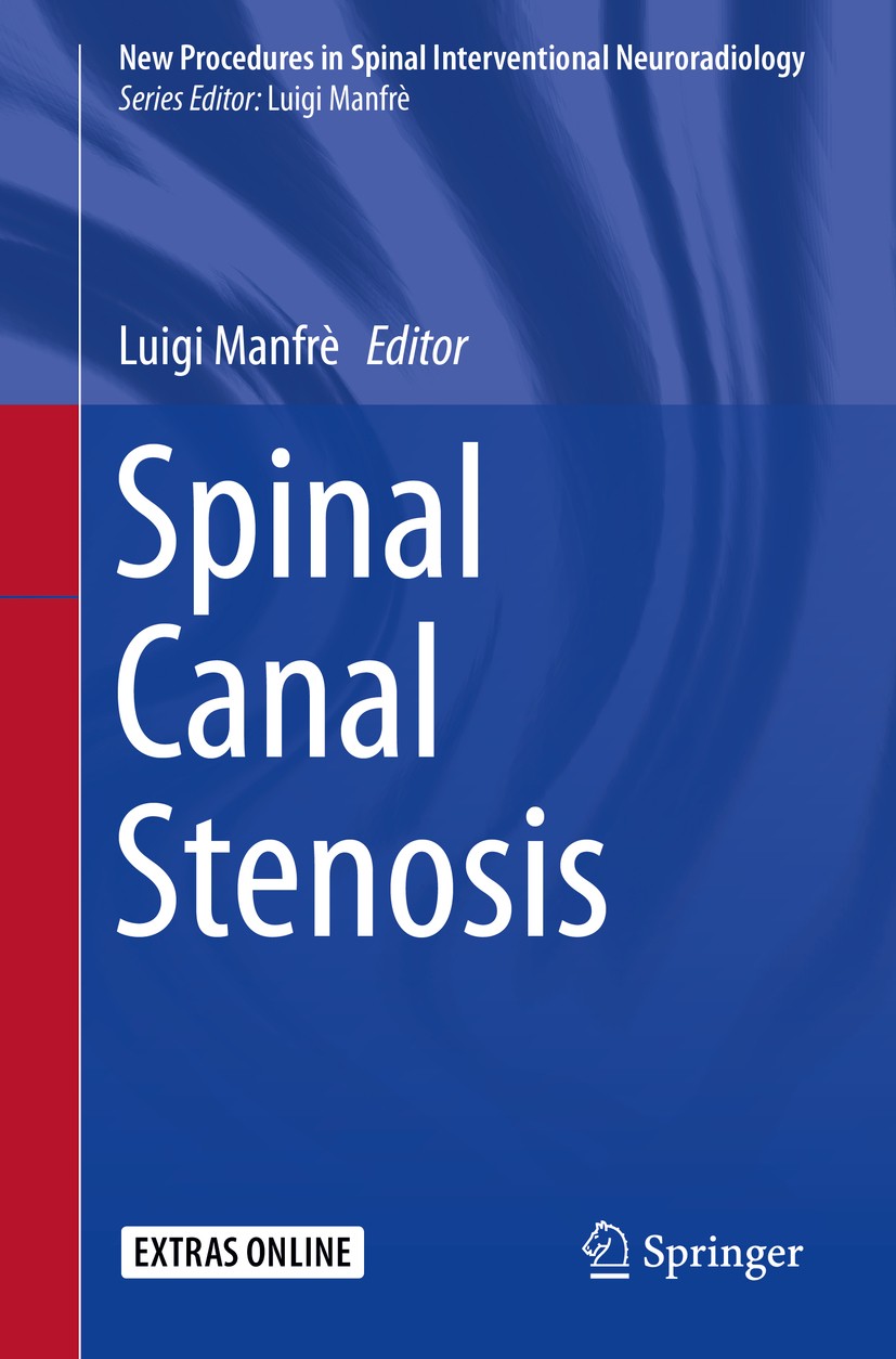 Titlebook: Spinal Canal Stenosis; Luigi Manfrè Book 2016 The Editor(s) (if applicable) and The Author(s), under exclusive license to Springer Nature Titlebook: Spinal Canal Stenosis; Luigi Manfrè Book 2016 The Editor(s) (if applicable) and The Author(s), under exclusive license to Springer Nature