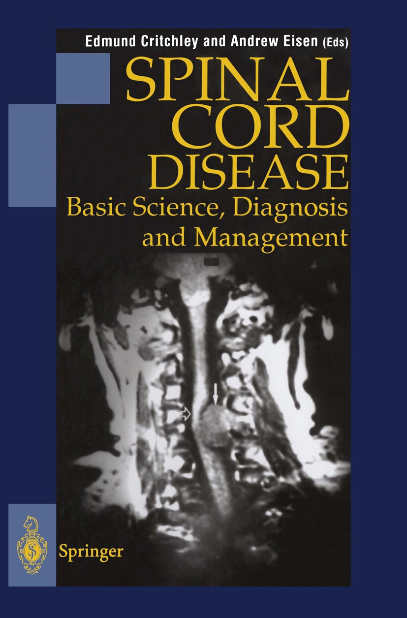 Titlebook: Spinal Cord Disease; Basic Science, Diagn Edmund Critchley,Andrew Eisen Book 1997Latest edition Springer-Verlag London Limited 1997 cell.em Titlebook: Spinal Cord Disease; Basic Science, Diagn Edmund Critchley,Andrew Eisen Book 1997Latest edition Springer-Verlag London Limited 1997 cell.em
