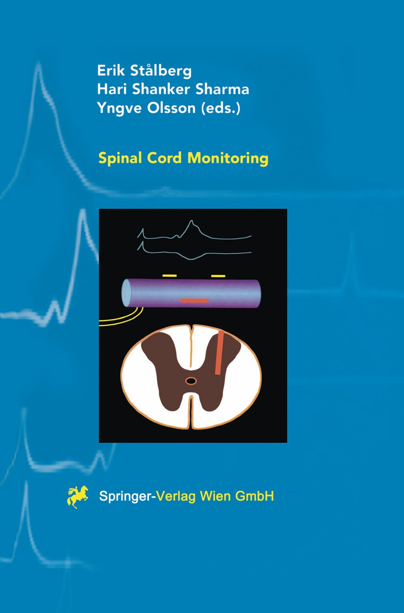 Titlebook: Spinal Cord Monitoring; Basic Principles, Re Erik Stålberg,Hari Shanker Sharma,Yngve Olsson Book 1998 Springer-Verlag Wien 1998 Neurology.e Titlebook: Spinal Cord Monitoring; Basic Principles, Re Erik Stålberg,Hari Shanker Sharma,Yngve Olsson Book 1998 Springer-Verlag Wien 1998 Neurology.e