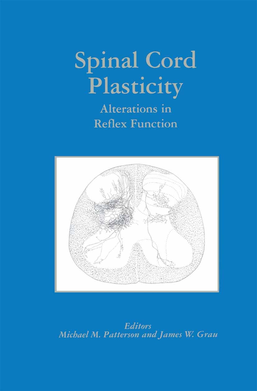 Titlebook: Spinal Cord Plasticity; Alterations in Refle Michael M. Patterson,James W. Grau Book 2001 Springer Science+Business Media New York 2001 bra Titlebook: Spinal Cord Plasticity; Alterations in Refle Michael M. Patterson,James W. Grau Book 2001 Springer Science+Business Media New York 2001 bra