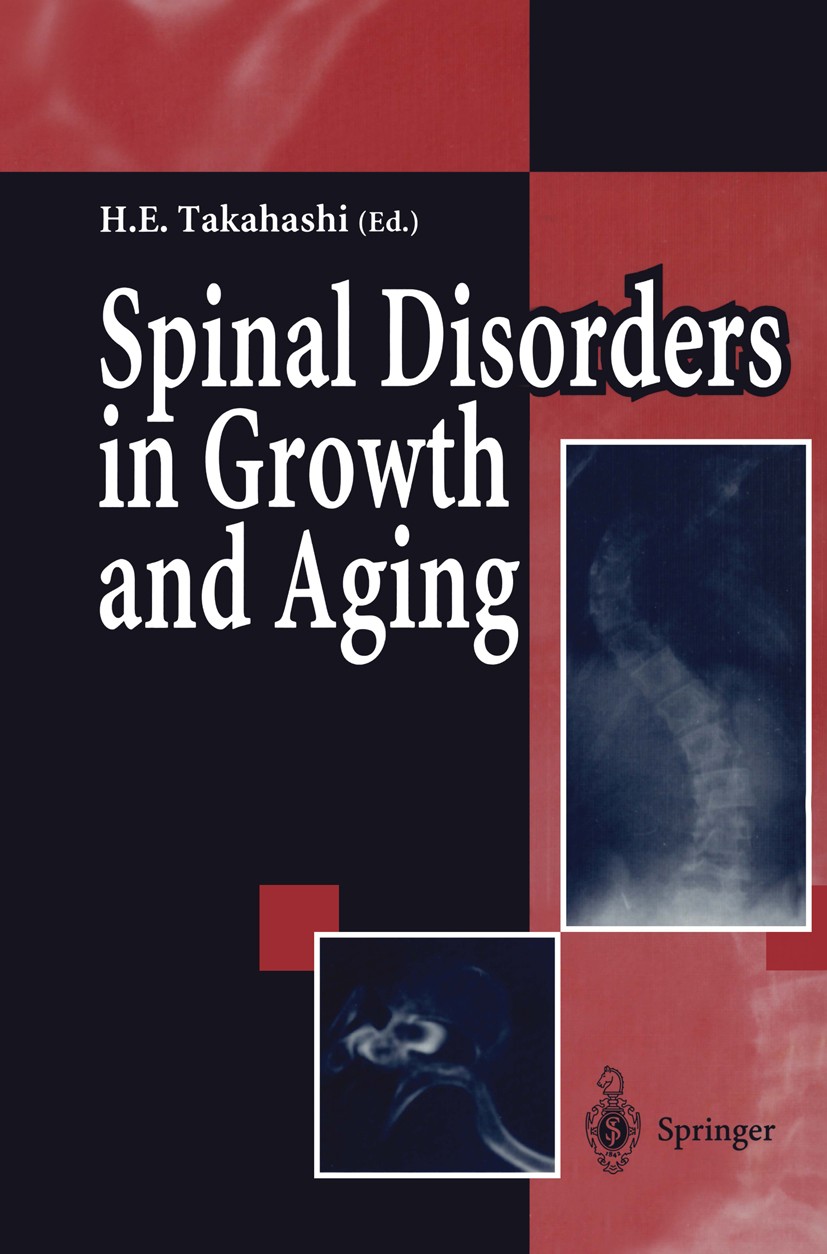 Titlebook: Spinal Disorders in Growth and Aging; Hideaki E. Takahashi Conference proceedings 1995 Springer Japan 1995 Spinal disorders.biomechanics.g Titlebook: Spinal Disorders in Growth and Aging; Hideaki E. Takahashi Conference proceedings 1995 Springer Japan 1995 Spinal disorders.biomechanics.g
