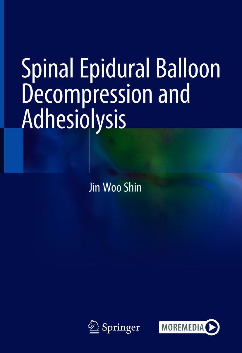 Titlebook: Spinal Epidural Balloon Decompression and Adhesiolysis; Jin Woo Shin Book 2021 Springer Nature Singapore Pte Ltd. 2021 ZiNeu catheter.dege Titlebook: Spinal Epidural Balloon Decompression and Adhesiolysis; Jin Woo Shin Book 2021 Springer Nature Singapore Pte Ltd. 2021 ZiNeu catheter.dege