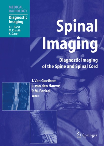 Titlebook: Spinal Imaging; Diagnostic Imaging o Johan W. M. Goethem,Luc Hauwe,Paul M. Parizel Book 2007 Springer-Verlag Berlin Heidelberg 2007 Neurolo Titlebook: Spinal Imaging; Diagnostic Imaging o Johan W. M. Goethem,Luc Hauwe,Paul M. Parizel Book 2007 Springer-Verlag Berlin Heidelberg 2007 Neurolo