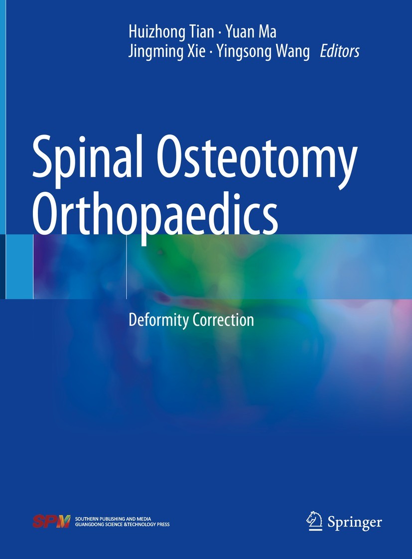 Titlebook: Spinal Osteotomy Orthopaedics; Deformity Correction Huizhong Tian,Yuan Ma,Yingsong Wang Book 2021 Guangdong Science & Technology Press Co., Titlebook: Spinal Osteotomy Orthopaedics; Deformity Correction Huizhong Tian,Yuan Ma,Yingsong Wang Book 2021 Guangdong Science & Technology Press Co.,