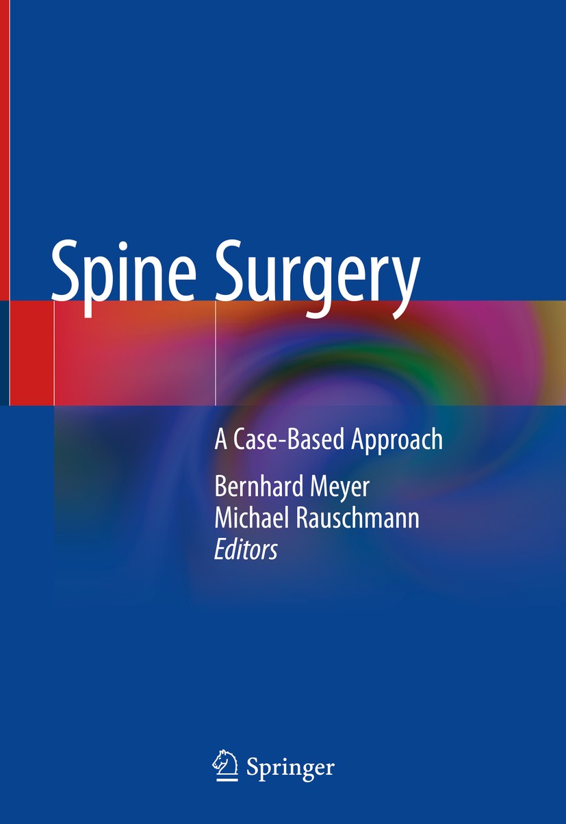 Titlebook: Spine Surgery; A Case-Based Approac Bernhard Meyer,Michael Rauschmann Textbook 2019 Springer Nature Switzerland AG 2019 spinal deformity.sp Titlebook: Spine Surgery; A Case-Based Approac Bernhard Meyer,Michael Rauschmann Textbook 2019 Springer Nature Switzerland AG 2019 spinal deformity.sp